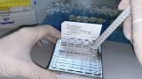 Роспотребнадзор: В России зафиксированы единичные случаи оспы обезьян